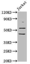 CHRNB2 Polyclonal Antibody (20 µl)