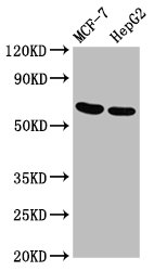 GNAS Polyclonal Antibody (100 µl)