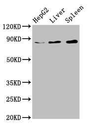 NSUN2 Polyclonal Antibody (100 µl)