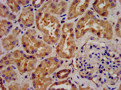 ATAT1 Polyclonal Antibody (100 µl)