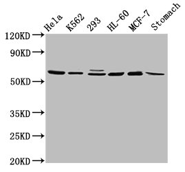 GATAD2A Polyclonal Antibody (100 µl)
