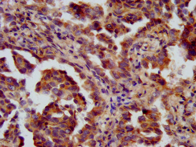 FANCL Polyclonal Antibody (100 µl)