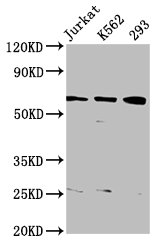 ELP3 Polyclonal Antibody (100 µl)