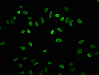 HIST1H3A (K4) Acetyl Polyclonal Antibody (50 µl)