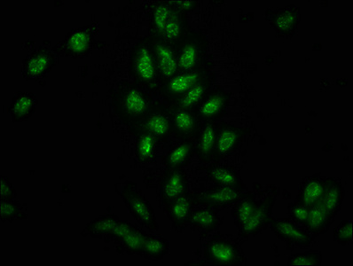 Phospho HIST1H3A (Y41) Polyclonal Antibody (100 µl)