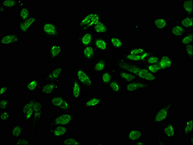 Phospho HIST1H3A (T80) Polyclonal Antibody (50 µl)