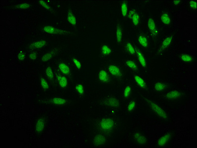 Crotonyl HIST1H3A (K18) Polyclonal Antibody (50 µl)