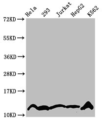 Crotonyl HIST1H4A (K5) Polyclonal Antibody (100 µl)