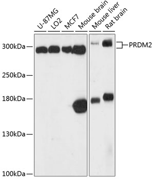 PRDM2 Polyclonal Antibody (50 µl)