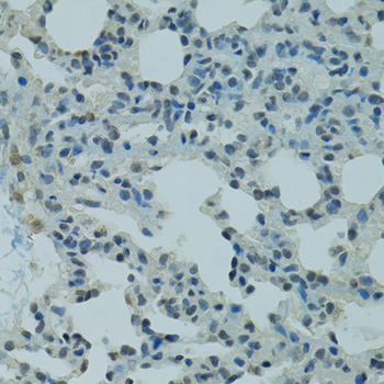 PRDM2 Polyclonal Antibody (50 µl)