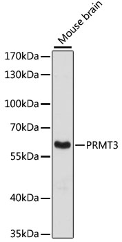 PRMT3 Polyclonal Antibody (50 µl)