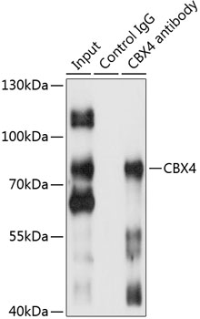 CBX4 Polyclonal Antibody (50 µl)