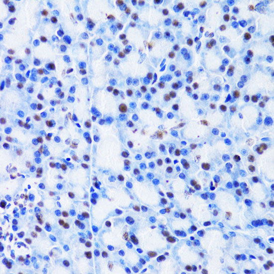 CBX8 Polyclonal Antibody (100 µl)