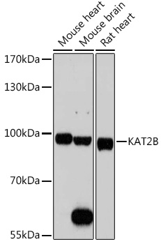 KAT2B Polyclonal Antibody (50 µl)