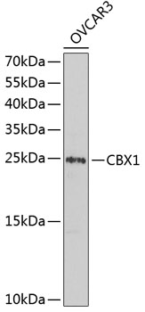 CBX1 Polyclonal Antibody (100 µl)