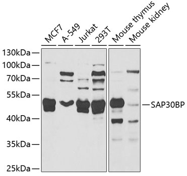 SAP30BP Polyclonal Antibody (50 µl)