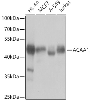 ACAA1 Polyclonal Antibody (100 µl)