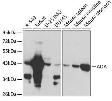 ADA Polyclonal Antibody (100 µl)