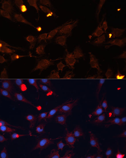 ADAMTS4 Polyclonal Antibody (100 µl)