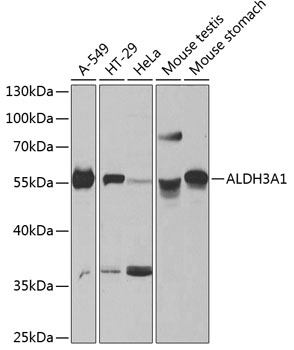 ALDH3A1 Polyclonal Antibody (100 µl)