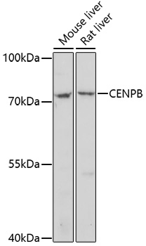CENPB Polyclonal Antibody (100 µl)