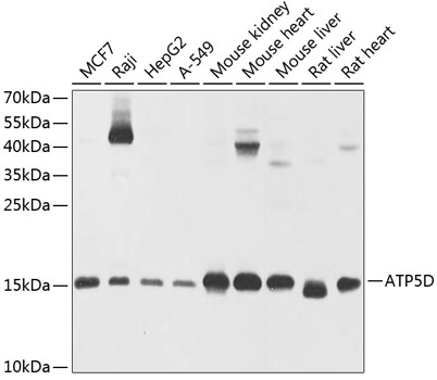 ATP5D Polyclonal Antibody (50 µl)