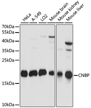 CNBP Polyclonal Antibody (50 µl)