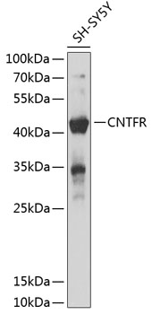 CNTFR Polyclonal Antibody (100 µl)