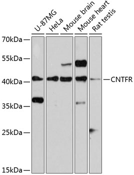 CNTFR Polyclonal Antibody (100 µl)