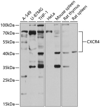 CXCR4 Polyclonal Antibody (100 µl)