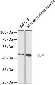 FIBP Polyclonal Antibody (50 µl)