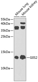 G0S2 Polyclonal Antibody (100 µl)