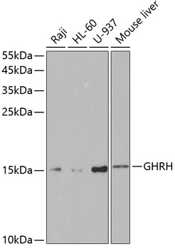 GHRH Polyclonal Antibody (100 µl)