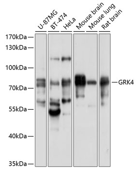 GRK4 Polyclonal Antibody (100 µl)
