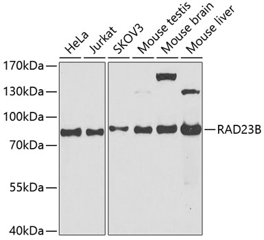 RAD23B Polyclonal Antibody (50 µl)