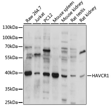 HAVCR1 Polyclonal Antibody (100 µl)