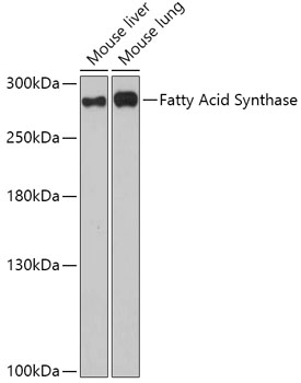 Fatty Acid Synthase Polyclonal Antibody (100 µl)