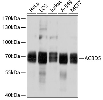 ACBD5 Polyclonal Antibody (50 µl)