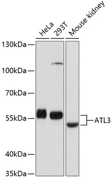 ATL3 Polyclonal Antibody (100 µl)