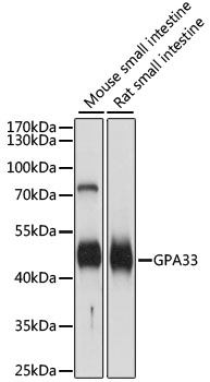 GPA33 Polyclonal Antibody (50 µl)