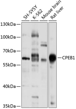 CPEB1 Polyclonal Antibody (50 µl)