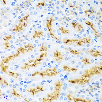CCL22 Polyclonal Antibody (50 µl)
