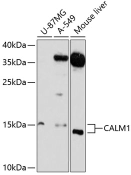 CALM1 Polyclonal Antibody (100 µl)