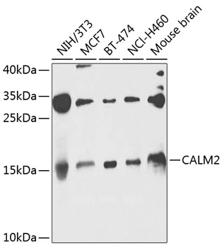CALM2 Polyclonal Antibody (50 µl)