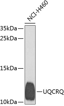 UQCRQ Polyclonal Antibody