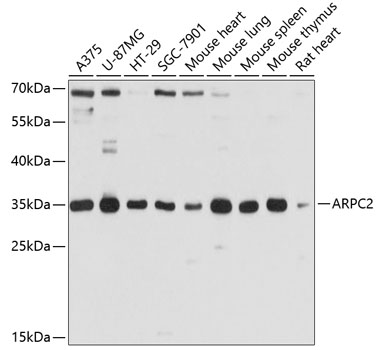 ARPC2 Polyclonal Antibody (100 µl)