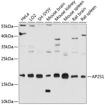 AP2S1 Polyclonal Antibody (50 µl)