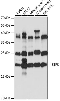 BTF3 Polyclonal Antibody (50 µl)