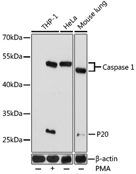 Caspase 1 Polyclonal Antibody (50 µl)