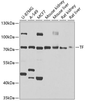 TF Polyclonal Antibody